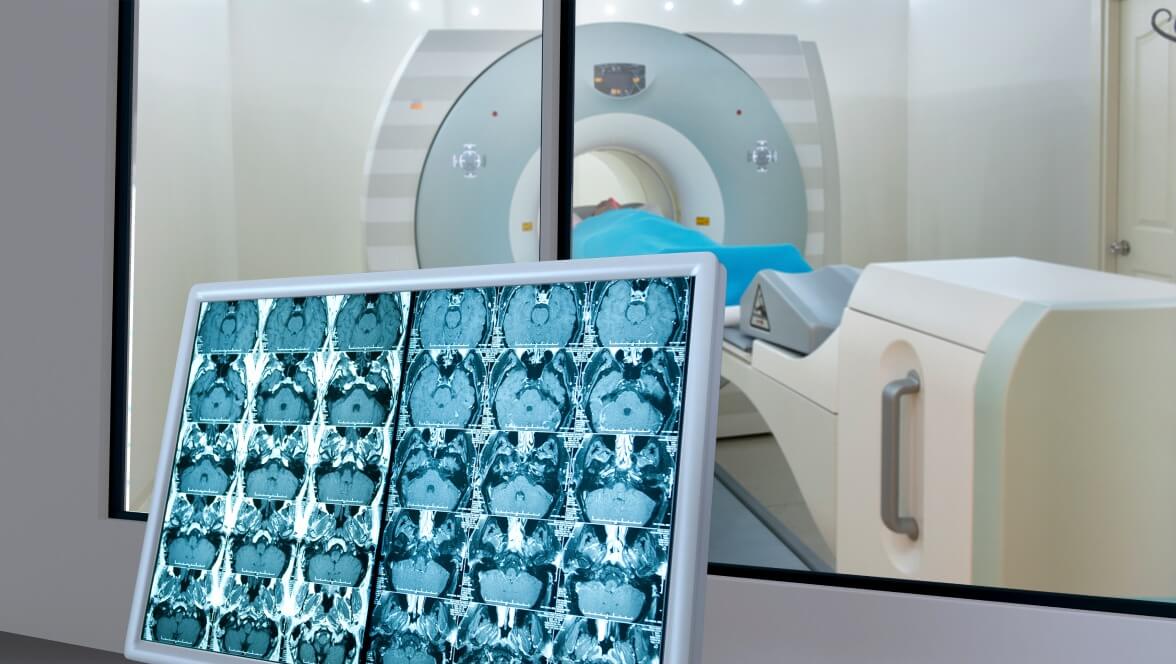 multiple images of mri image of brain